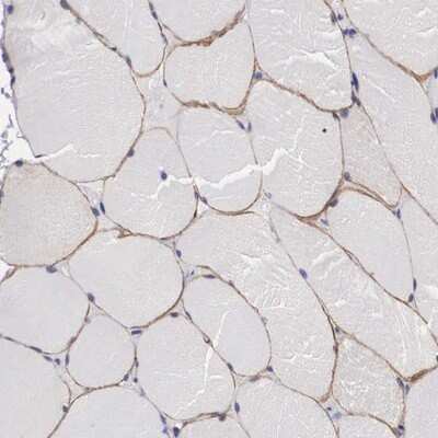 Immunohistochemistry-Paraffin: HS747E2A Antibody [NBP1-89963]