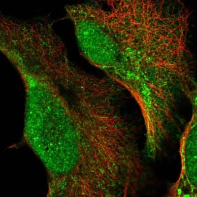 Immunocytochemistry/ Immunofluorescence: HSCB Antibody [NBP2-54997]