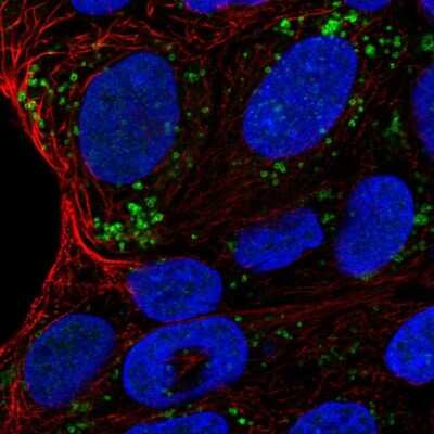 Immunocytochemistry/ Immunofluorescence: HSD11B2 Antibody [NBP2-37954]