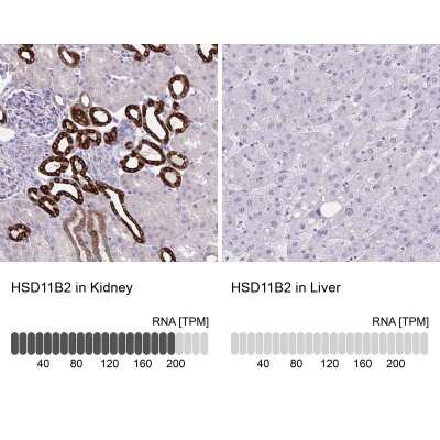 Immunohistochemistry-Paraffin: HSD11B2 Antibody [NBP2-37898]