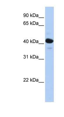 Western Blot: HSD11B2 Antibody [NBP1-53163]