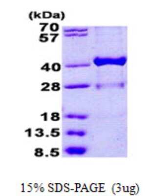 SDS-PAGE: Recombinant Human 17 beta-HSD1/HSD17B1 His Protein [NBP2-23127]
