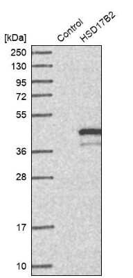 Western Blot: HSD17B2 Antibody [NBP1-92011]
