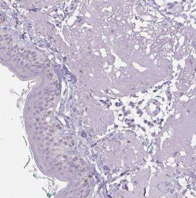 Immunohistochemistry-Paraffin: HSD17B3 Antibody [NBP2-38807]