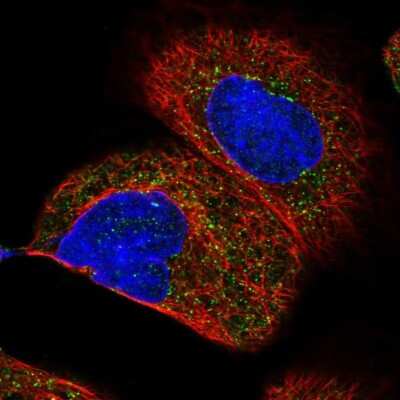 Immunocytochemistry/ Immunofluorescence: HSD17B4 Antibody [NBP1-85296]