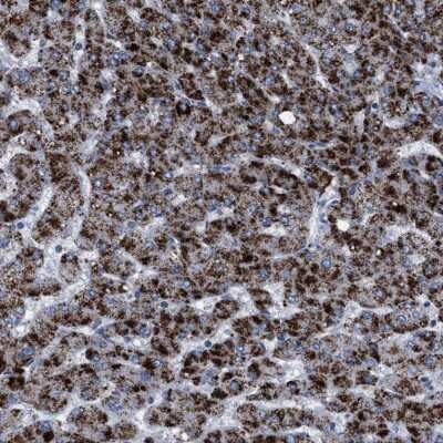Immunohistochemistry-Paraffin: HSD17B4 Antibody [NBP1-85295]
