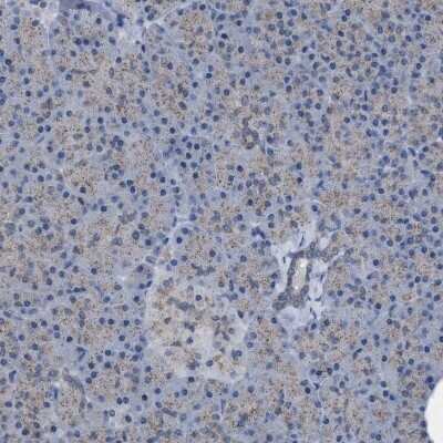 Immunohistochemistry-Paraffin: HSD17B4 Antibody [NBP1-85295]