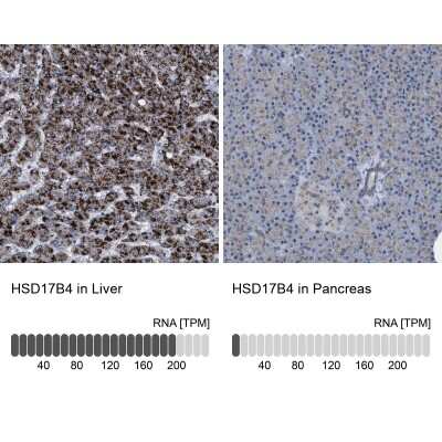 Immunohistochemistry-Paraffin: HSD17B4 Antibody [NBP1-85295]