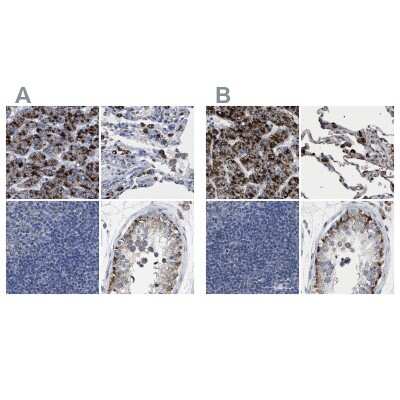 Immunohistochemistry-Paraffin: HSD17B4 Antibody [NBP1-85295]