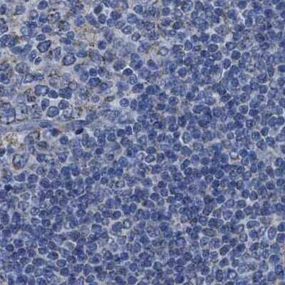 Immunohistochemistry-Paraffin: HSD17B4 Antibody [NBP1-85295]