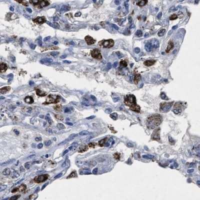 Immunohistochemistry-Paraffin: HSD17B4 Antibody [NBP1-85295]