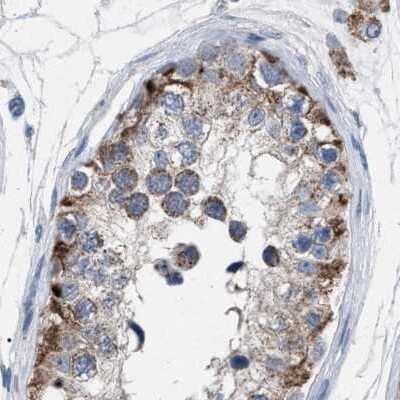 Immunohistochemistry-Paraffin: HSD17B4 Antibody [NBP1-85295]