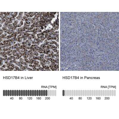 Immunohistochemistry-Paraffin: HSD17B4 Antibody [NBP1-85297]