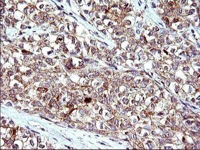 Immunohistochemistry: HSD17B4 Antibody (OTI4C4) - Azide and BSA Free [NBP2-70947]
