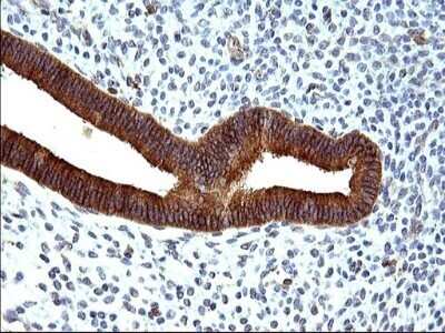 Immunohistochemistry: HSD17B4 Antibody (OTI4C4) - Azide and BSA Free [NBP2-70947]