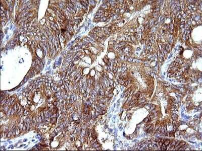 Immunohistochemistry: HSD17B4 Antibody (OTI4C4) [NBP2-46005]