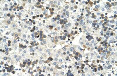 Immunohistochemistry-Paraffin: HSD17B6 Antibody [NBP1-56686]