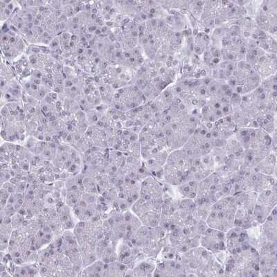 Immunohistochemistry-Paraffin: HSD17B6 Antibody [NBP2-32431]