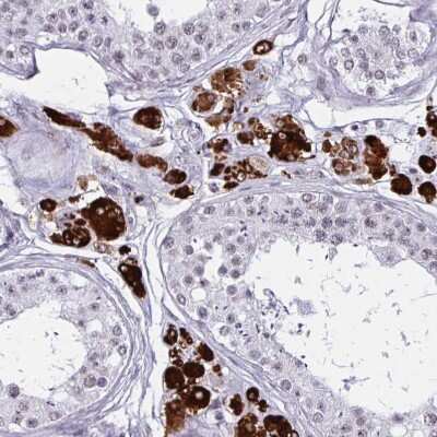 Immunohistochemistry-Paraffin: HSD17B6 Antibody [NBP2-32431]