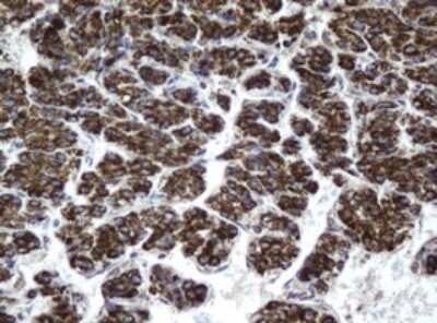 Immunohistochemistry: HSD17B8 Antibody (OTI2E12) [NBP2-46006]