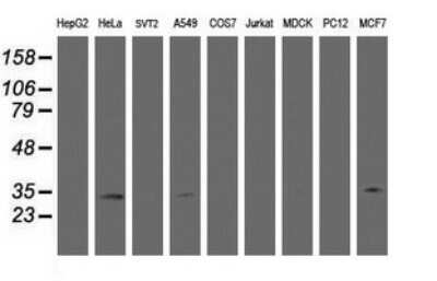 Western Blot: HSD17B8 Antibody (OTI2E12) [NBP2-46006]