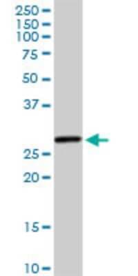Western Blot: HSD17B8 Antibody (4F1) [H00007923-M01]