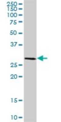 Western Blot: HSD17B8 Antibody [H00007923-B01P]