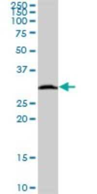 Western Blot: HSD17B8 Antibody [H00007923-B02P]