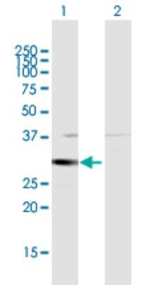 Western Blot: HSD17B8 Antibody [H00007923-D01P]
