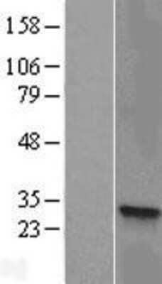 Western Blot: HSD17B8 Overexpression Lysate [NBL1-11731]