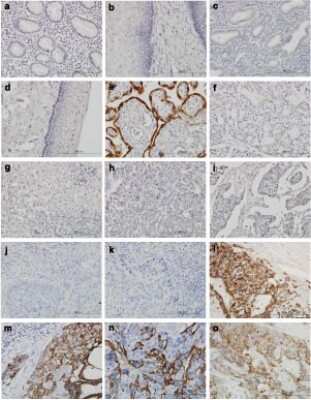 Immunohistochemistry-Paraffin: HSD3B1 Antibody (3C11-D4) [H00003283-M01]
