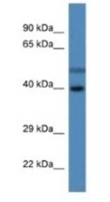 Western Blot: HSDL1 Antibody [NBP1-74267]