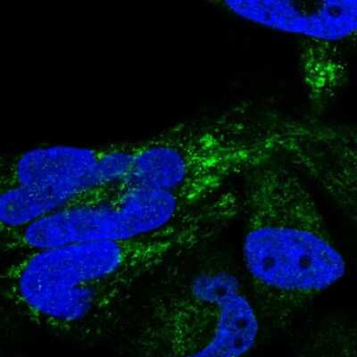 Immunocytochemistry/ Immunofluorescence: HSDL2 Antibody [NBP2-14104]
