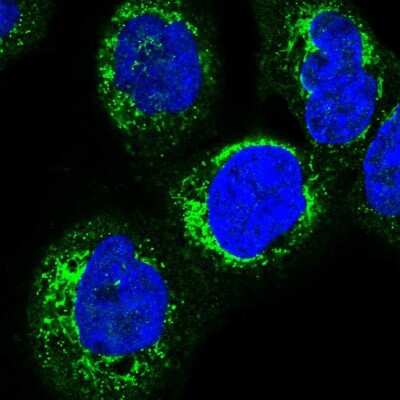 Immunocytochemistry/ Immunofluorescence: HSDL2 Antibody [NBP2-14105]