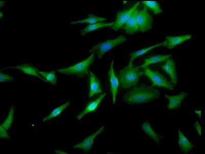 Immunocytochemistry/ Immunofluorescence: HSF1 Antibody (10H4) [NBP2-42205]