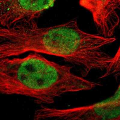 Immunocytochemistry/ Immunofluorescence: HSF1 Antibody [NBP1-81665]
