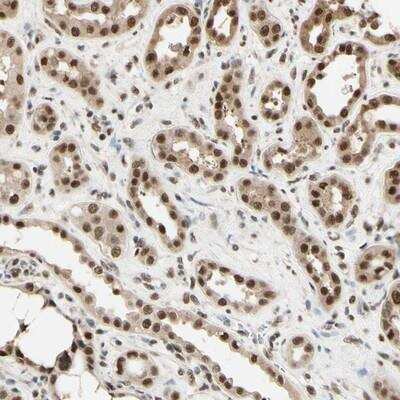 Immunohistochemistry-Paraffin: HSF1 Antibody [NBP1-81665]