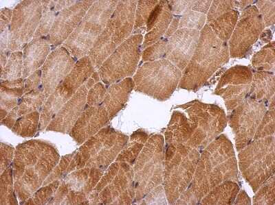 Immunohistochemistry-Paraffin: HSF2BP Antibody [NBP2-16887]
