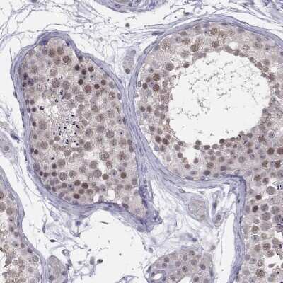 Immunohistochemistry-Paraffin: HSF2BP Antibody [NBP3-17056]