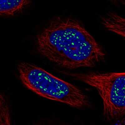 Immunocytochemistry/ Immunofluorescence: HSF4 Antibody [NBP2-58258]