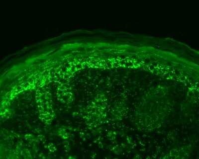 Immunohistochemistry: HSP10/EPF Antibody [NB110-11473]