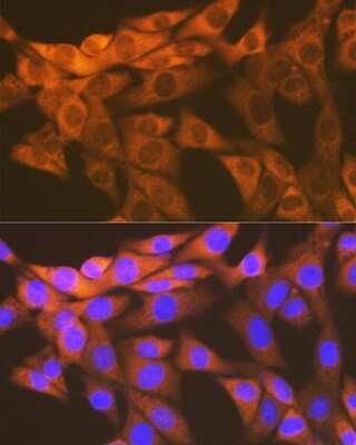 Immunocytochemistry/ Immunofluorescence: HSP10/EPF Antibody (0H0X6) [NBP3-16604]