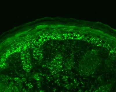 Immunohistochemistry: HSP10/EPF Antibody [NB110-11473]