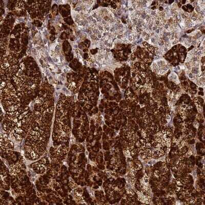 Immunohistochemistry-Paraffin: HSP10/EPF Antibody [NBP2-34055]