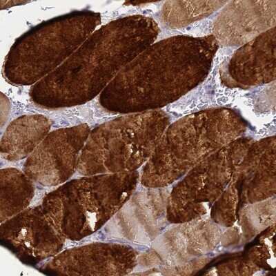 Immunohistochemistry-Paraffin: HSP20/HSPB6 Antibody [NBP2-32027]