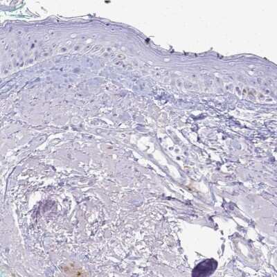 Immunohistochemistry-Paraffin: HSP20/HSPB6 Antibody [NBP2-38739]