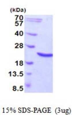 SDS-PAGE: Recombinant Human HSP20/HSPB6 His Protein [NBP2-52013]