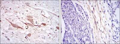 Immunohistochemistry: HSP27 Antibody (5D7) - BSA Free [NBP2-37599]
