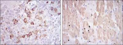 Immunohistochemistry: HSP27 Antibody (5D7) - BSA Free [NBP2-37599]
