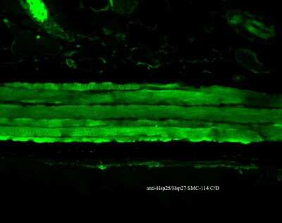 Immunohistochemistry: HSP27 Antibody (8A7) [NB110-96431]